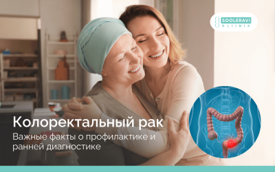 Колоректальный рак: важные факты о профилактике и ранней диагностике